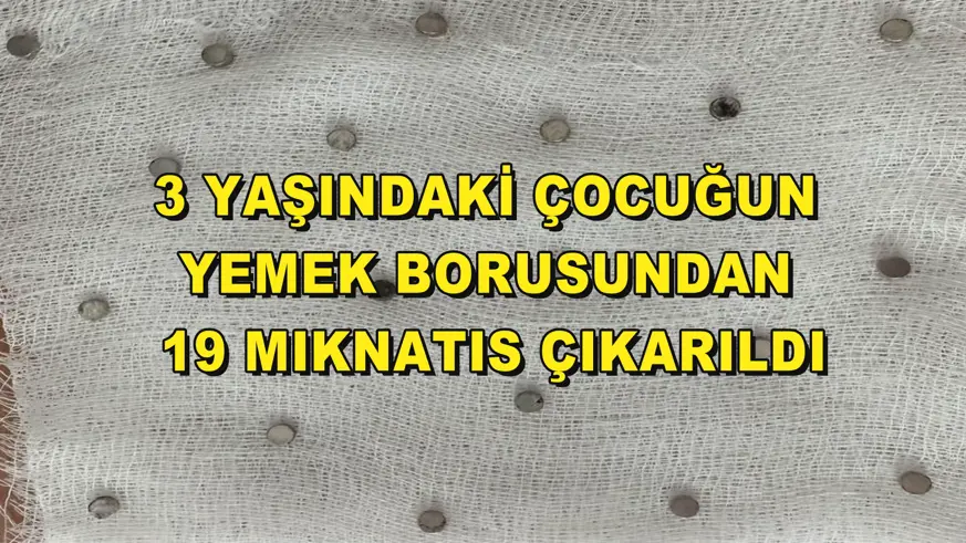 3 yaşındaki çocuğun yemek borusundan 19 mıknatıs çıkarıldı