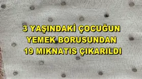 3 yaşındaki çocuğun yemek borusundan 19 mıknatıs çıkarıldı
