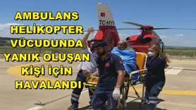 Ambulans helikopter vücudunda yanık oluşan kişi için havalandı