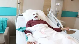 Tüpteki gaz kaçağını çakmakla kontrol etti