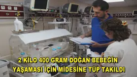2 kilo 400 gram doğan bebeğin yaşaması için midesine tüp takıldı