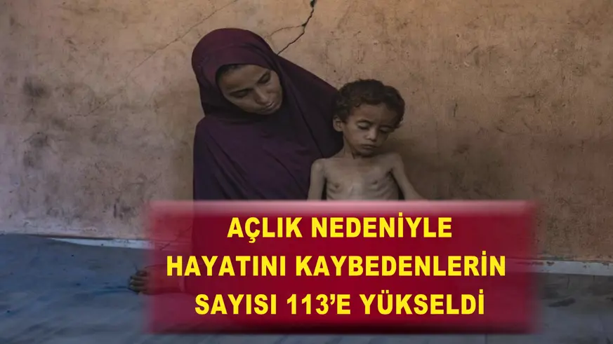 Açlık nedeniyle hayatını kaybedenlerin sayısı 113’e yükseldi