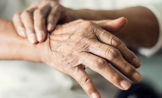 Bu hastalık Parkinson’dan 10 kat daha fazla görülüyor