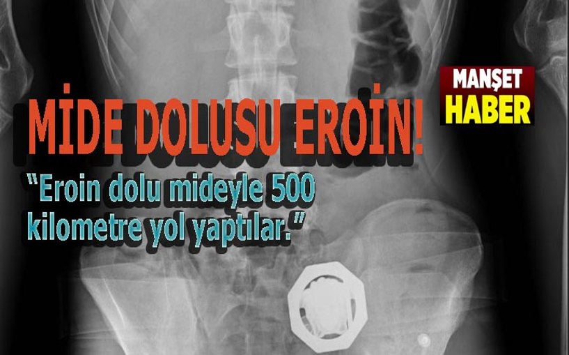 Mide dolusu eroin!