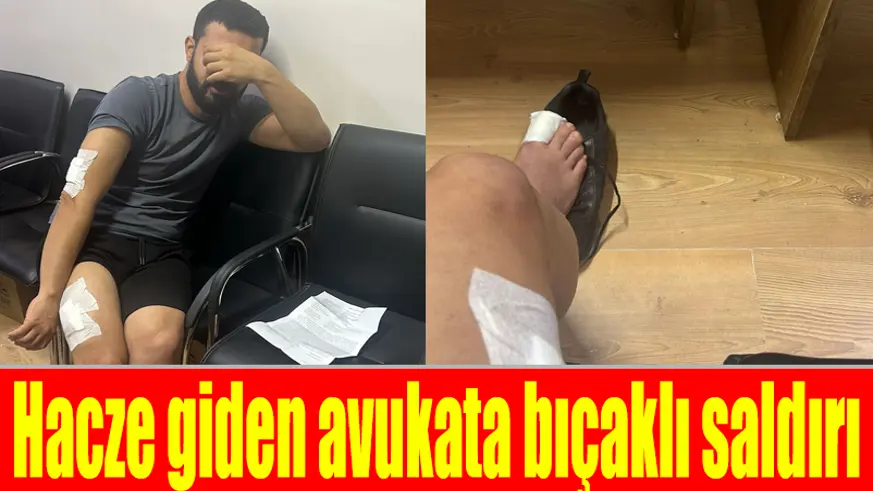 Haciz işlemi için aynı iş yerine giden 2. avukat da saldırıya uğradı